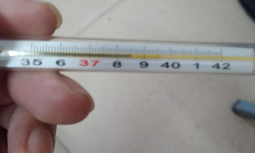 查黄疸需要做什么检查-黄疸病人查体网 - 黄疸体格检查怎么写,查黄疸需要做什么检查